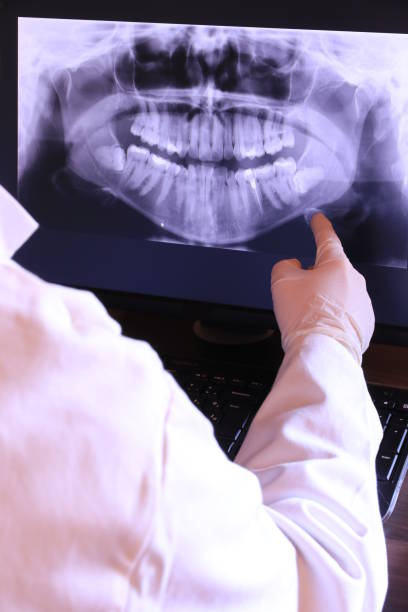 Best Emergency Denture Repair in Rockville, MD