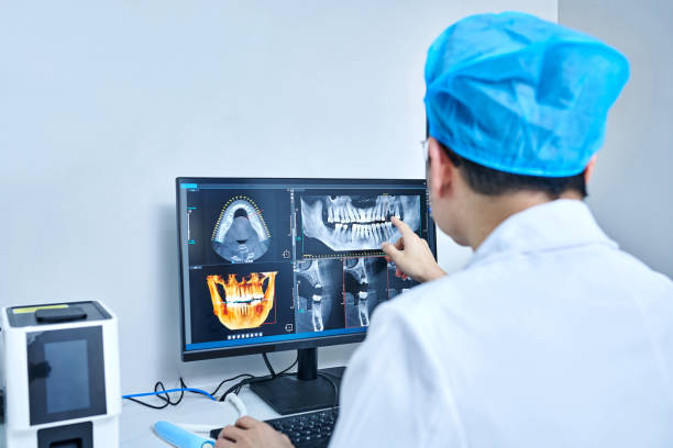 Best Emergency Treatment for Dental Infections or Abscesses in Rockville, MD