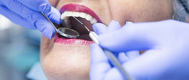 Best Emergency Dental Care for Broken or Chipped Teeth in Rockville, MD